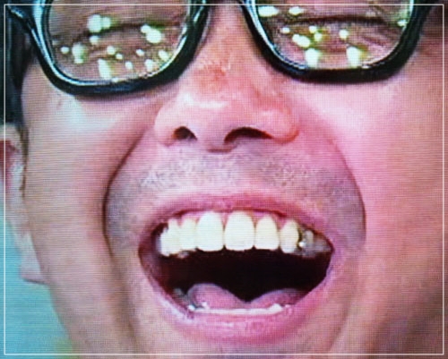 ウエストランド井口の前歯は歯列矯正済み？歯並びが気持ち悪いと話題！