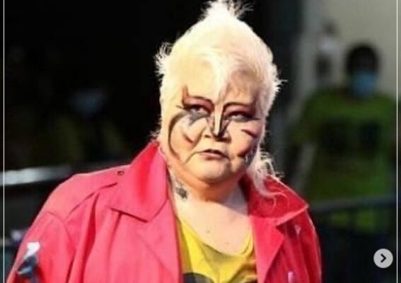 ダンプ松本の足が悪いのは病気？理由は5つ！現役引退しないのはなぜ？